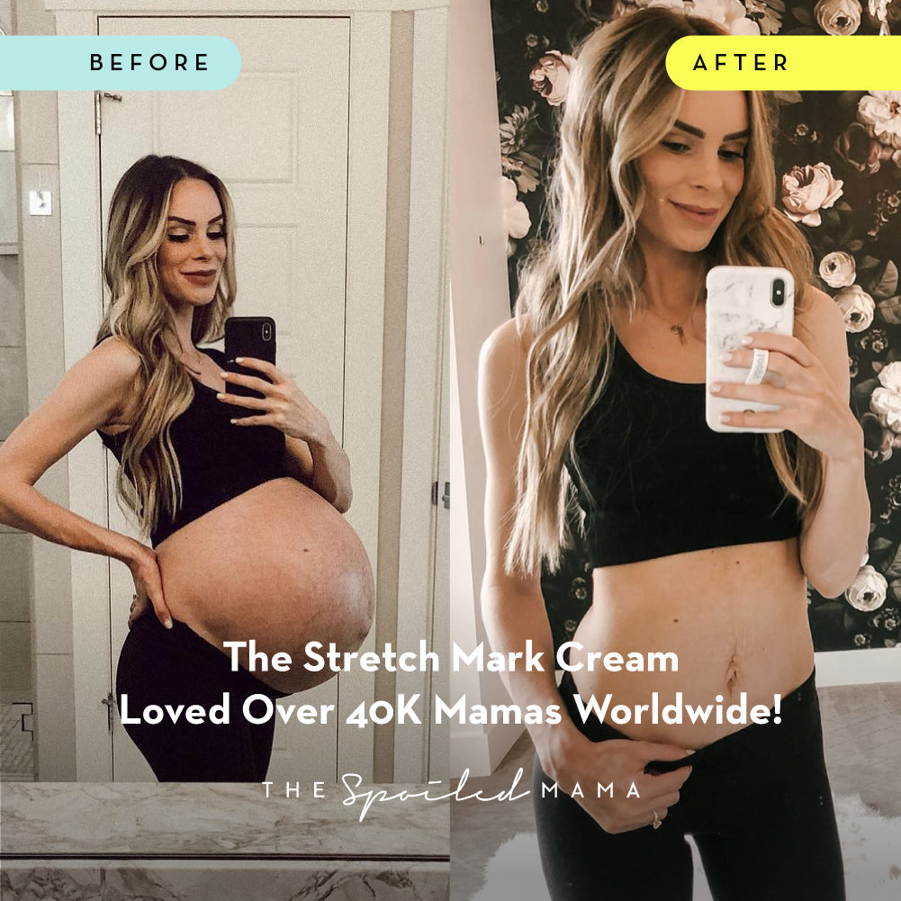 Stretch Marks & Pregnancy: How to Care for Your Skin as It Grows