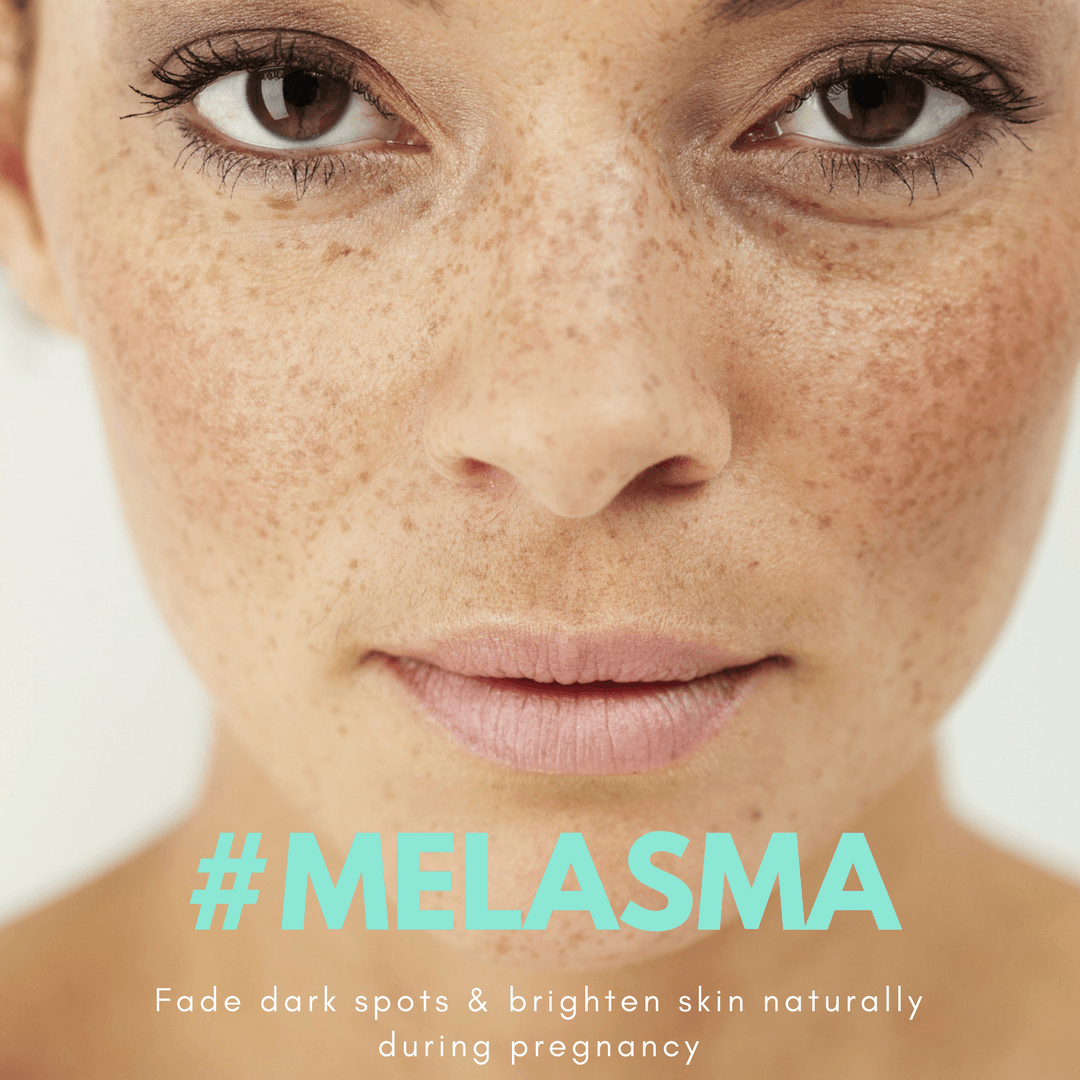 Pregnancy care: Fade dark spots & brighten skin naturally