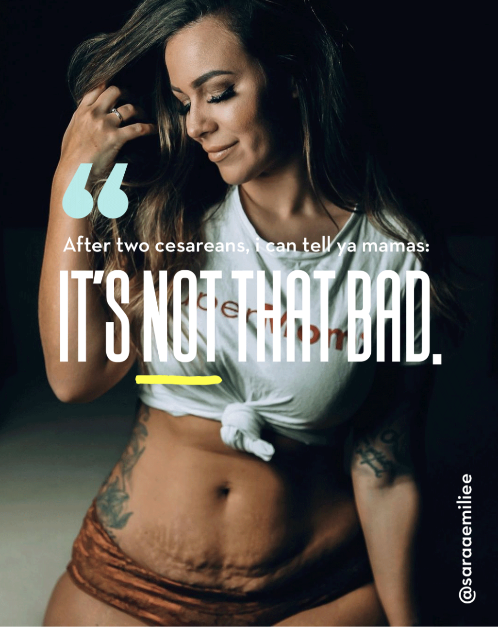 ic:C-Section Scar Treatment & Recovery Skincare