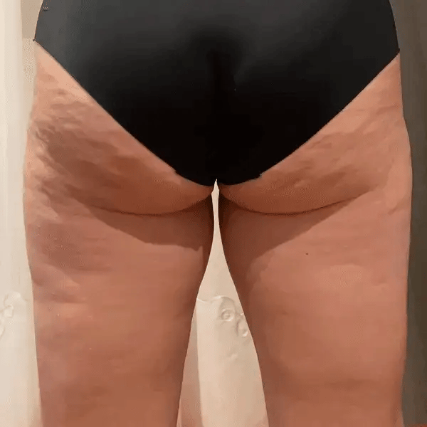Cheek Chic postpartum cellulite gel pregnancy safe