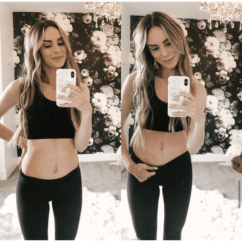 Woman taking a mirror selfie wearing a black sports bra and leggings in front of a floral wall showing before and after stretch mark