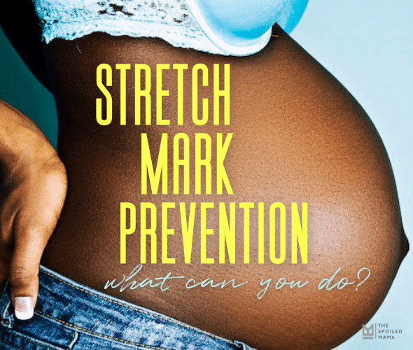 stretch marks on my stomach during pregnancy