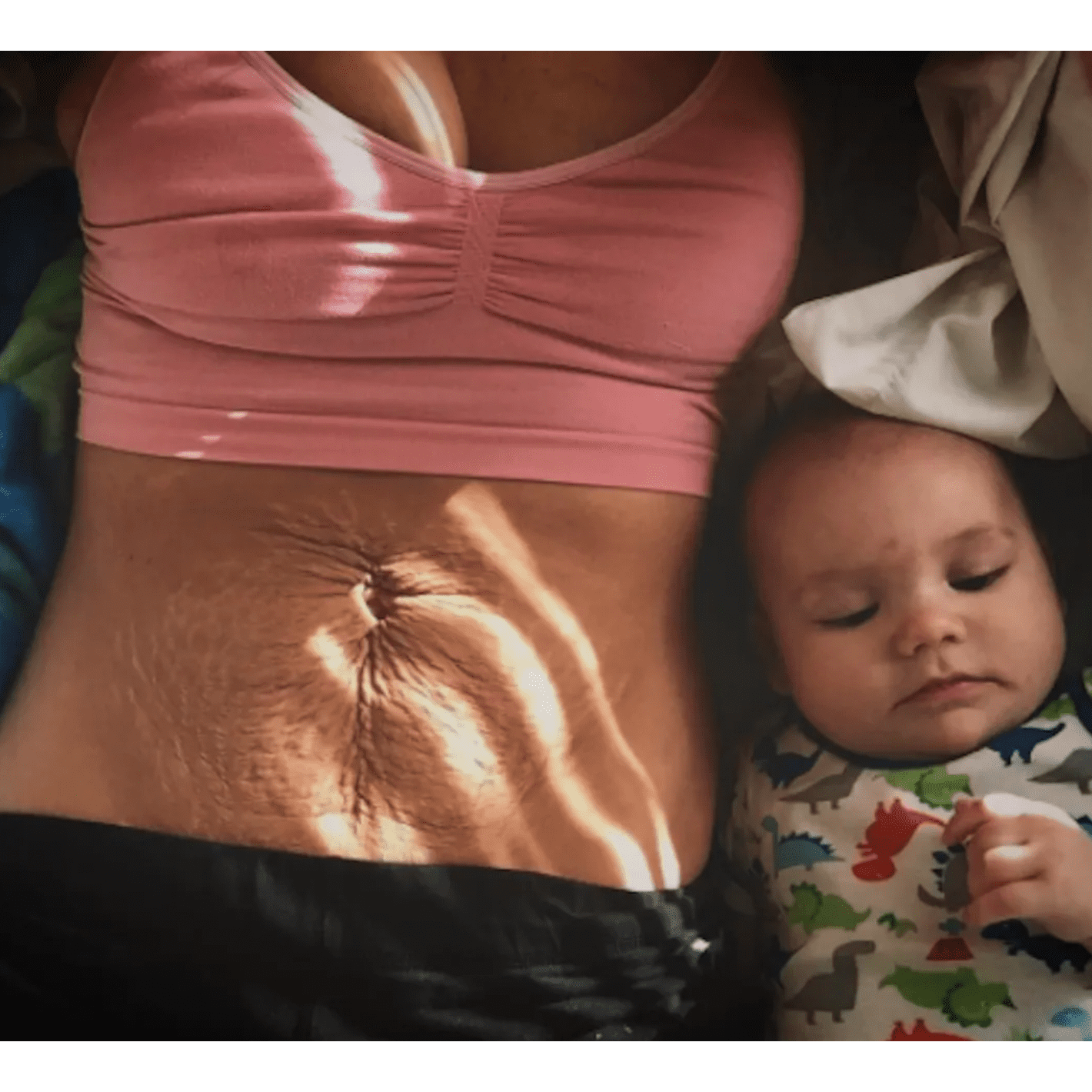 Best body ever: 5 Postpartum skincare resolutions