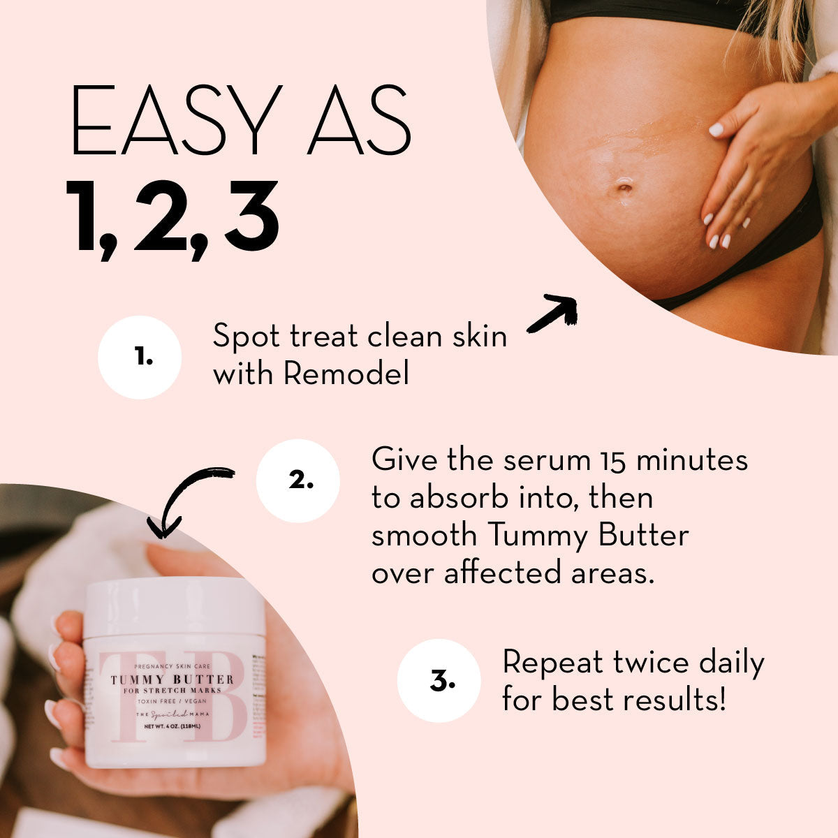 Pregnancy Belly Cream > New Mom Gift > Gift For Pregnant Woman > Pregnancy Creams To Prevent Stretch Marks > Stretch Mark Treatment - Bye, Bye Stretchies Duo
