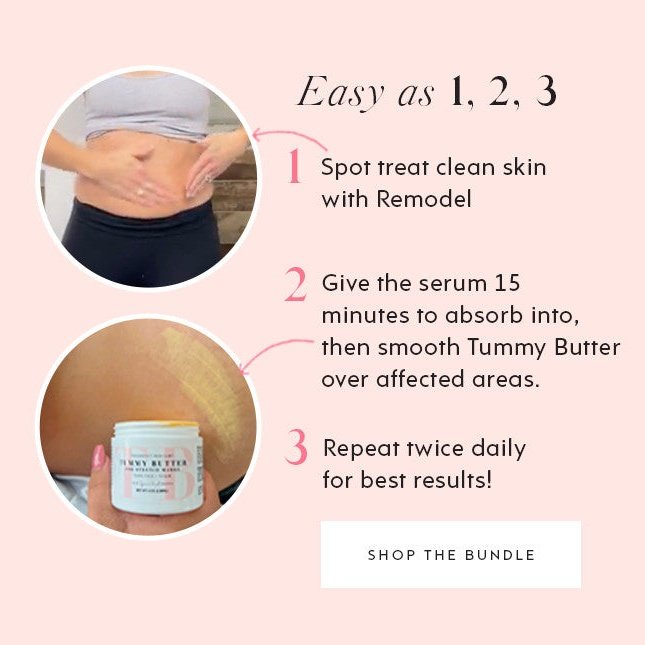 stretch mark serum for scars